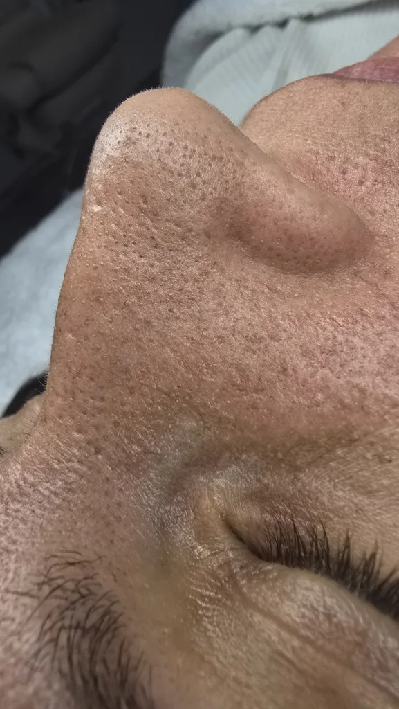 Wann braucht deine Haut eine professionelle Tiefenreinigung? 20250716 111326 577x1024