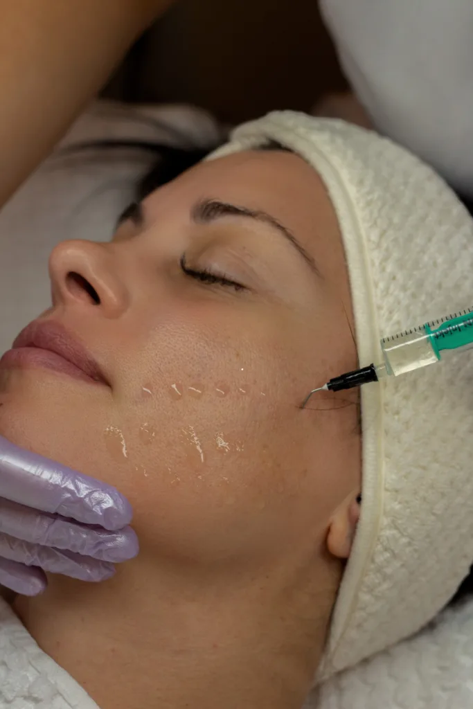 PRX Biorevitalisierung Winterthur