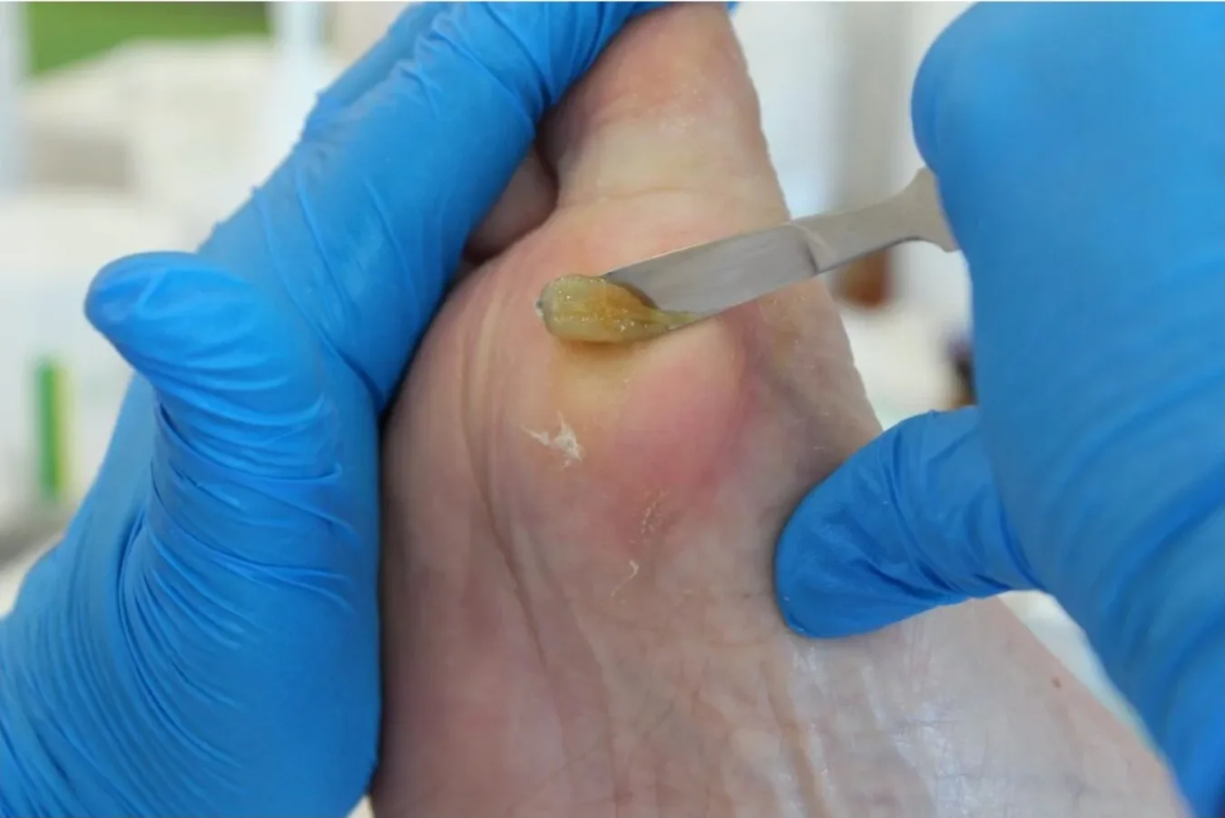 Kart Pediküre Winterthur