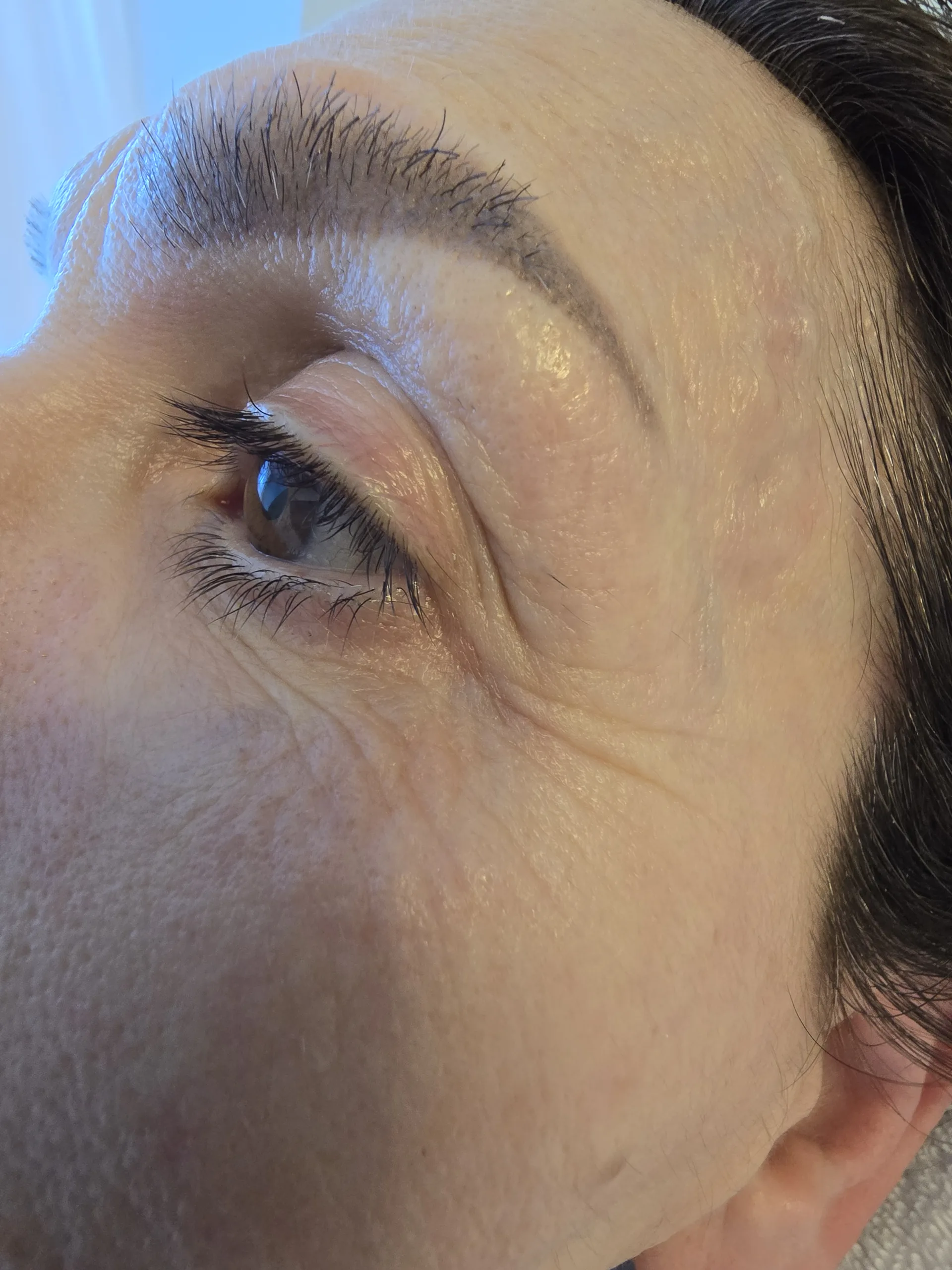 Nachher Gesichtsbehandlung Larisa Cosmetic
