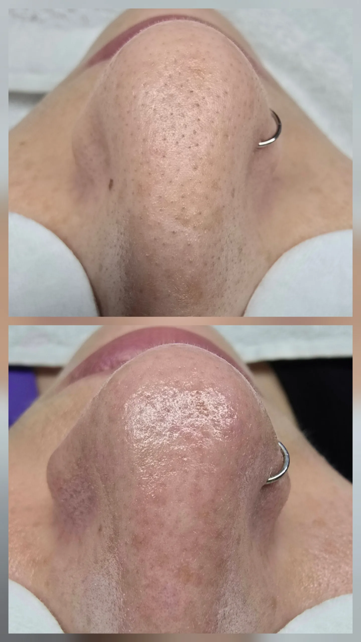 Strahlende Haut nach professioneller Gesichtsreinigung