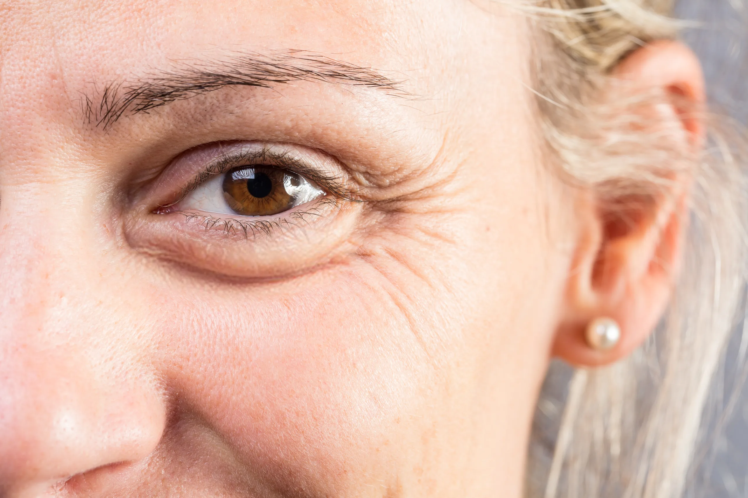 Krähenfüsse Falten Auge